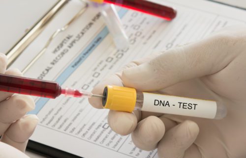 Anordnung einer DNA-Identitätsfeststellung bei Verdacht einer Straftat