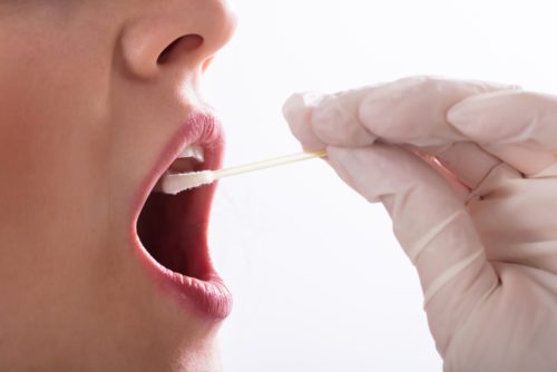DNA-Identitätsfeststellung nur bei Straftaten von erheblicher Bedeutung