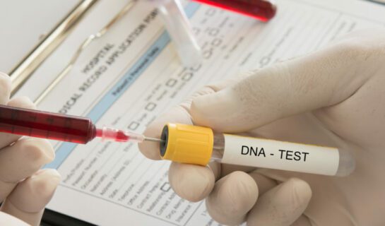 Anordnung einer DNA-Identitätsfeststellung nach vorläufiger Verfahrenseinstellung