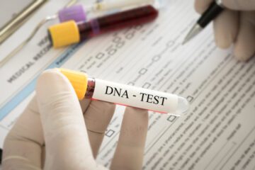 DNA-Identitätsfestellung – Verhältnismäßigkeitsgrundsatz bei der Anordnung