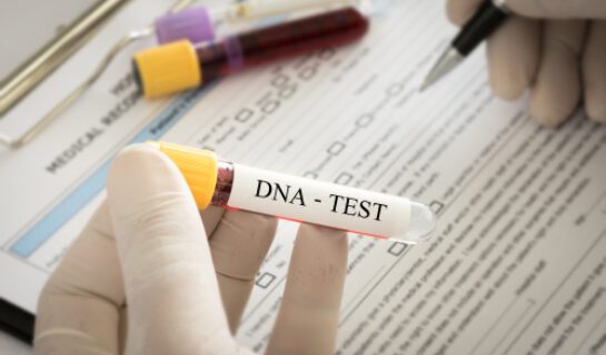DNA-Identitätsfestellung – Verhältnismäßigkeitsgrundsatz bei der Anordnung