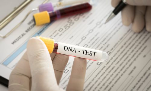 DNA-Identitätsfestellung - Verhältnismäßigkeitsgrundsatz bei der Anordnung