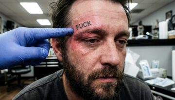 Mann mit frischer „Fuck“-Tätowierung über der Augenbraue, gerötete Haut und betroffener Gesichtsausdruck.
